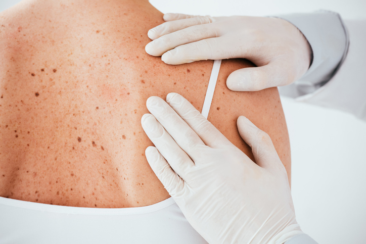 dermatologia - dermatologo a quarrata - Studi Medici gli Olmi