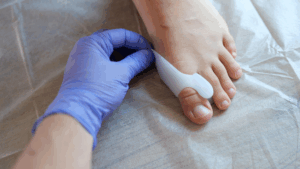 ortesi digitali in silicone